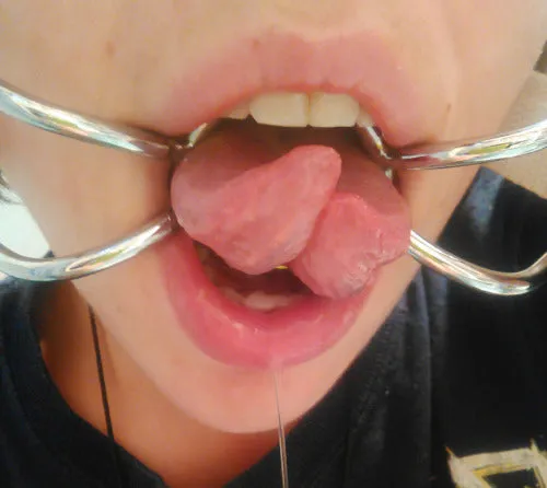 Spider Gag